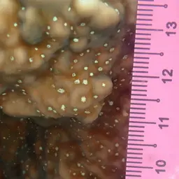 Ridge Coral, photo 8